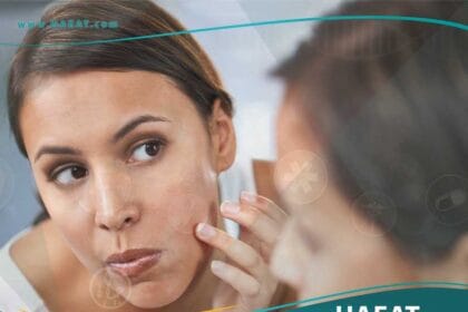 تجميل جروح الوجه