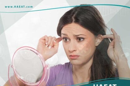 تجميل الأذن البارزة