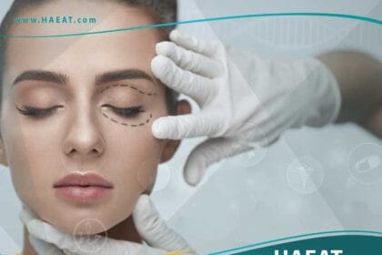 عملية تجميل العيون الغائرة