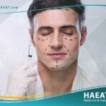 تجميل الوجه للرجال