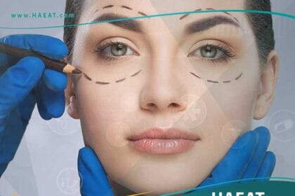 عمليات تجميل العيون