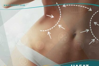 عمليات التجميل نحت الجسم