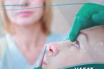 عمليات تجميل الانف