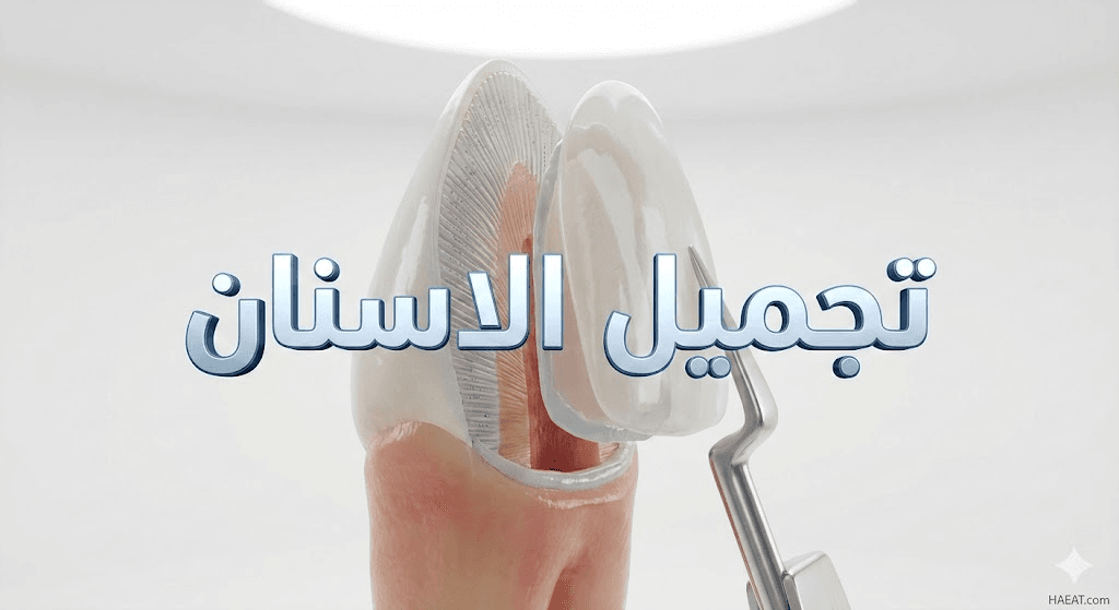 تجميل الاسنان | 7 تقنيات حديثة ومبهرة 20 image 19