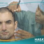 الفرق بين مستشفى ومركز زراعة شعر وشركة سياحة علاجية