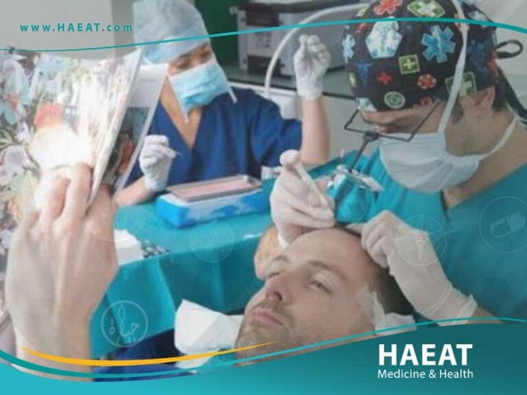 الفرق بين مستشفى زراعة شعر ومركز وعيادة زراعة شعر