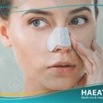 تجميل الانف ثلاثي الابعاد