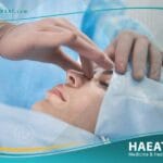 اسعار عمليات تجميل الانف