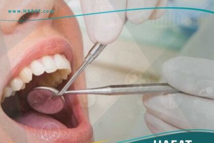 تجميل الأسنان بدون تقويم