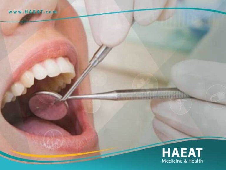 تجميل الأسنان بدون تقويم