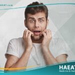 اسباب فشل زراعة الشعر