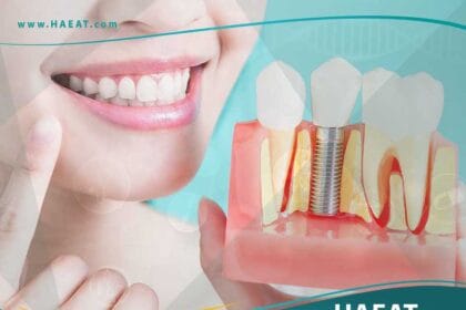 تجميل وزراعة الاسنان