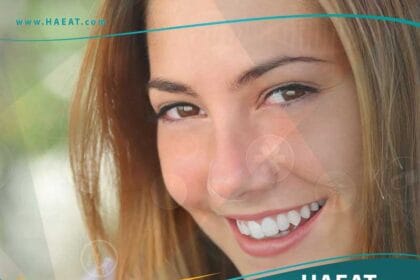 تجميل الأسنان هوليود سمايل