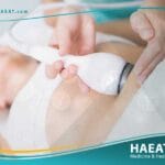 علاج السمنة بالليزر