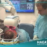 التطورات الحديثة في مجال زراعة الشعر