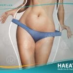 تجميل شكل الجسم