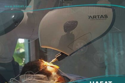 زراعة الشعر بالروبوت أرتاس ARTAS
