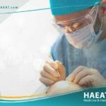 تقنيات زراعة الشعر