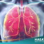 الربو القصبي