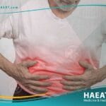 حرقة المعدة