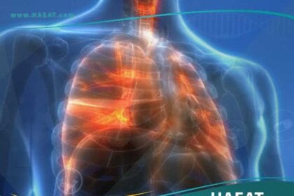 الالتهاب الرئوي