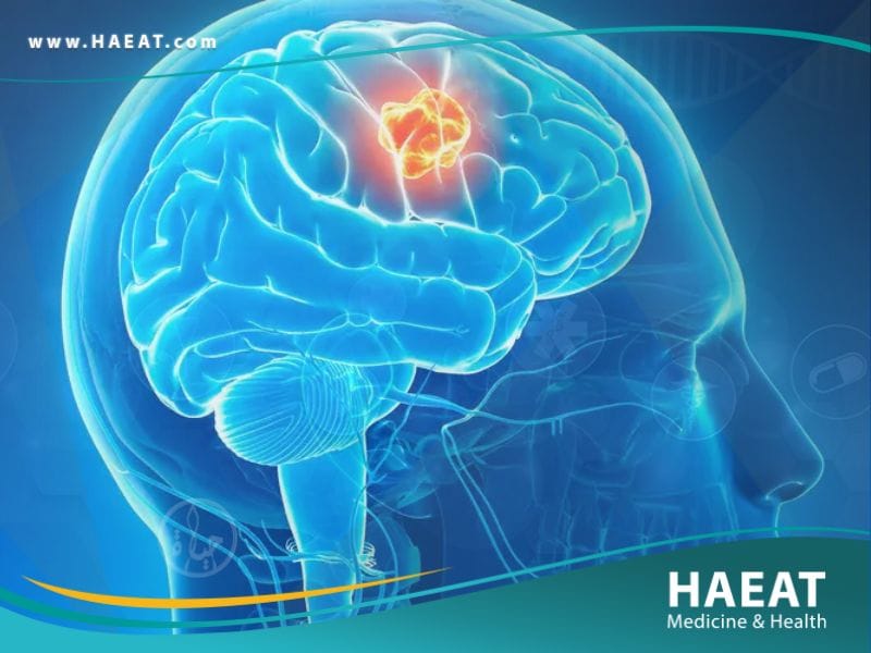 سرطان الدماغ