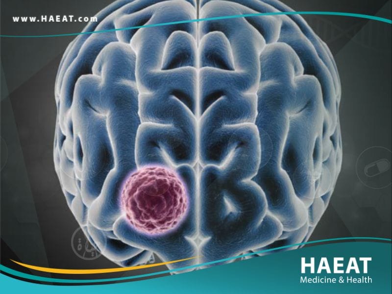 سرطان الدماغ