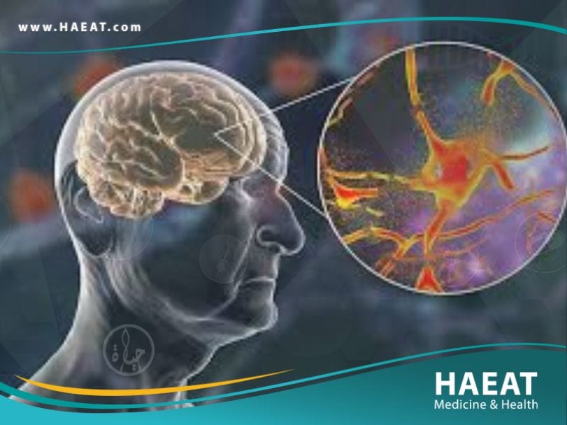 فقدان الذاكرة