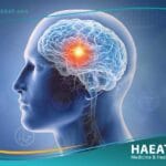 سرطان الدماغ