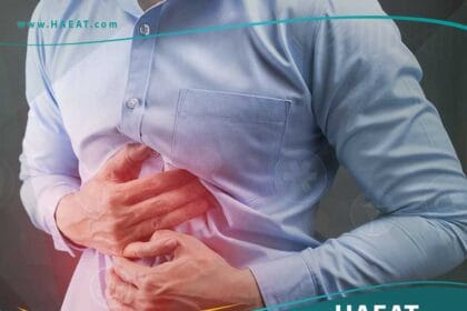 قرحة المعدة