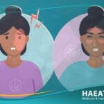 الصداع النصفي