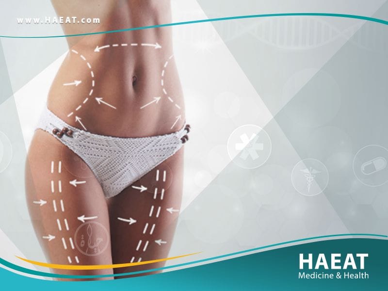 نحت الجسم في تركيا