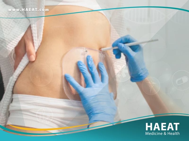 نحت الجسم في تركيا