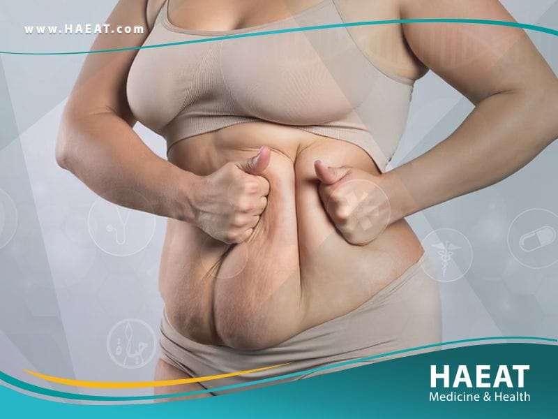 نحت الجسم في تركيا