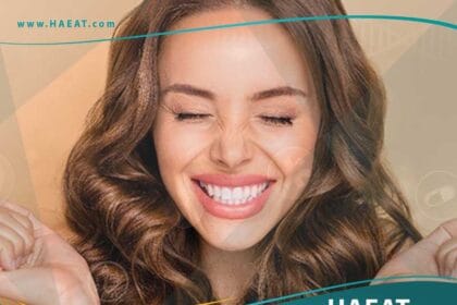 ابتسامة هوليوود