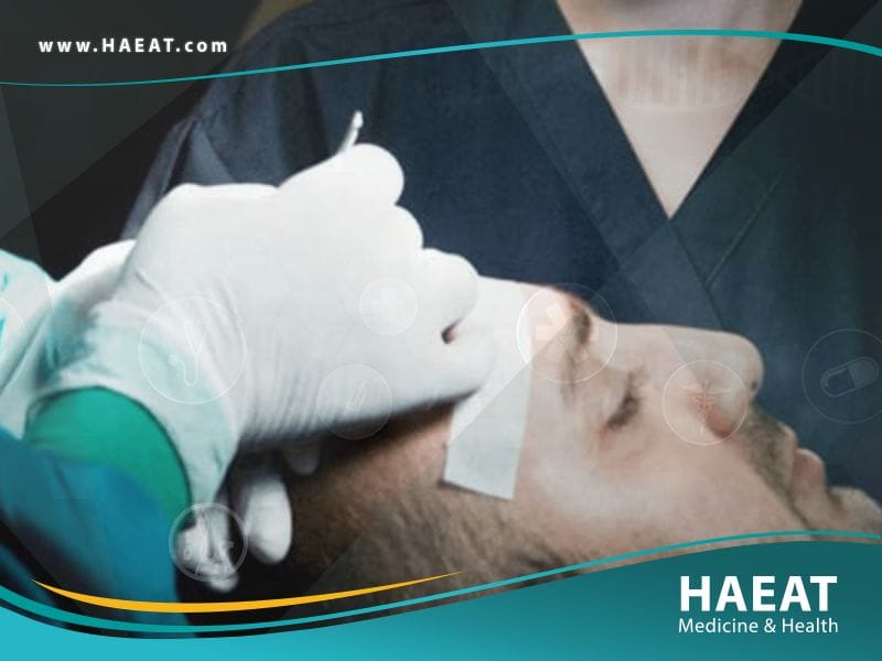 زراعة الشعر بتقنية الإقتطاف الدقيق Nano Fue | 5 مزايا 24 زراعة الشعر بتقنية الإقتطاف الدقيق