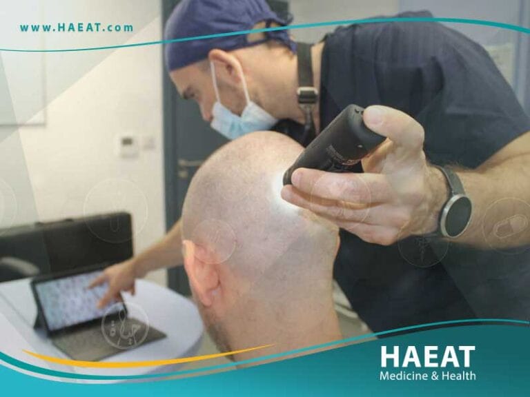 ما هو أفضل مركز لزراعة الشعر في تركيا