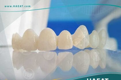 تيجان أسنان الزركونيا