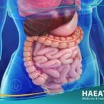 استئصال المعي اللفائفي