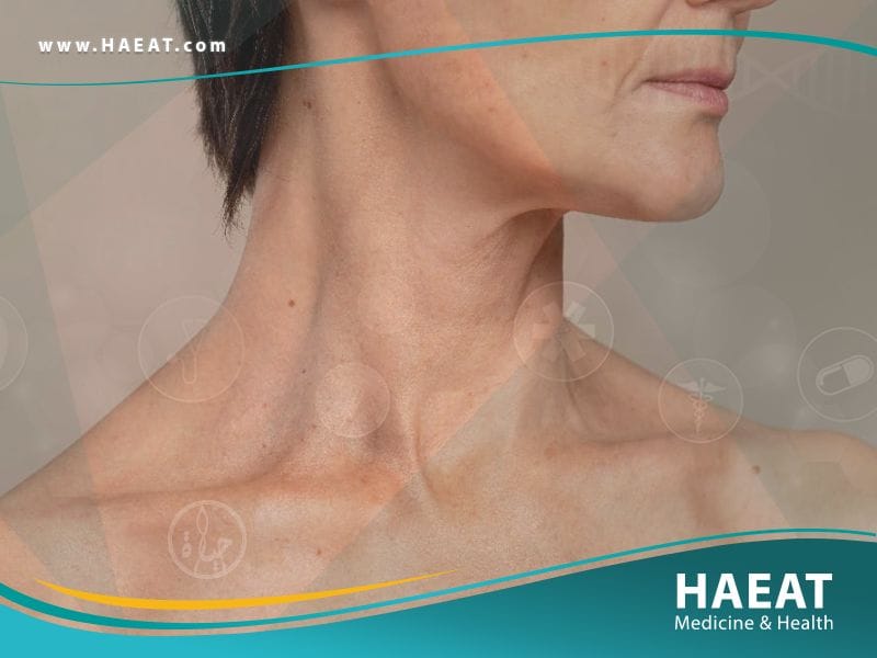 عملية شد الرقبة