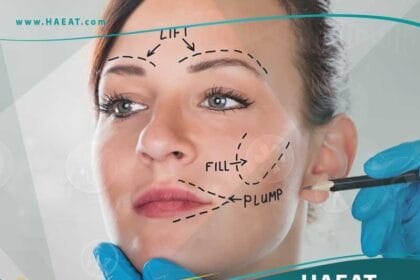 جراحة شد الوجه