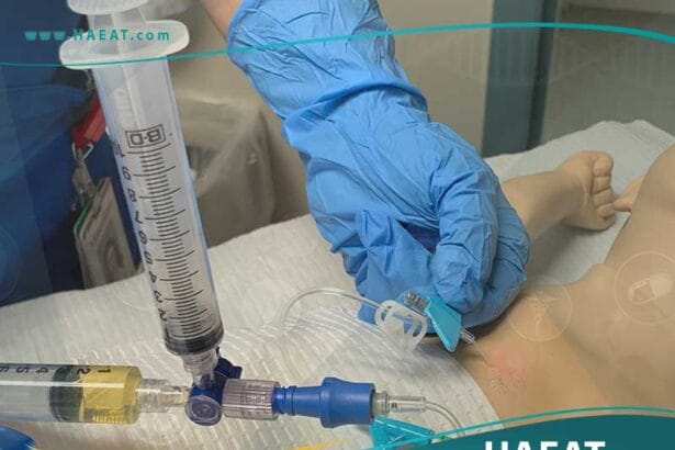القثطرة لعلاج الاضطرابات في نظم القلب