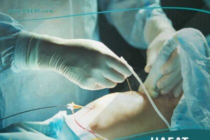 جراحة الأوعية الدموية