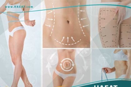 عملية إذابة الدهون بالليزر Laser Lipolysis