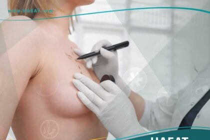 تكبير الصدر بحقن الدهون الذاتية