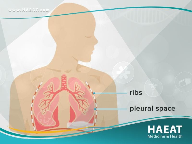 تقشير الرئة