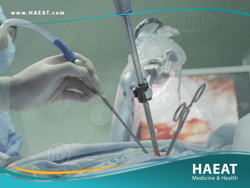 تقشير الرئة