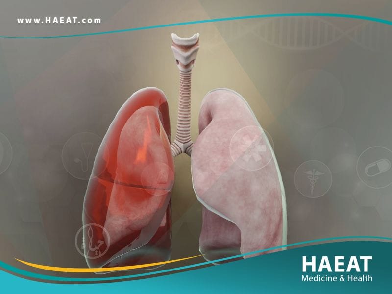 تقشير الرئة