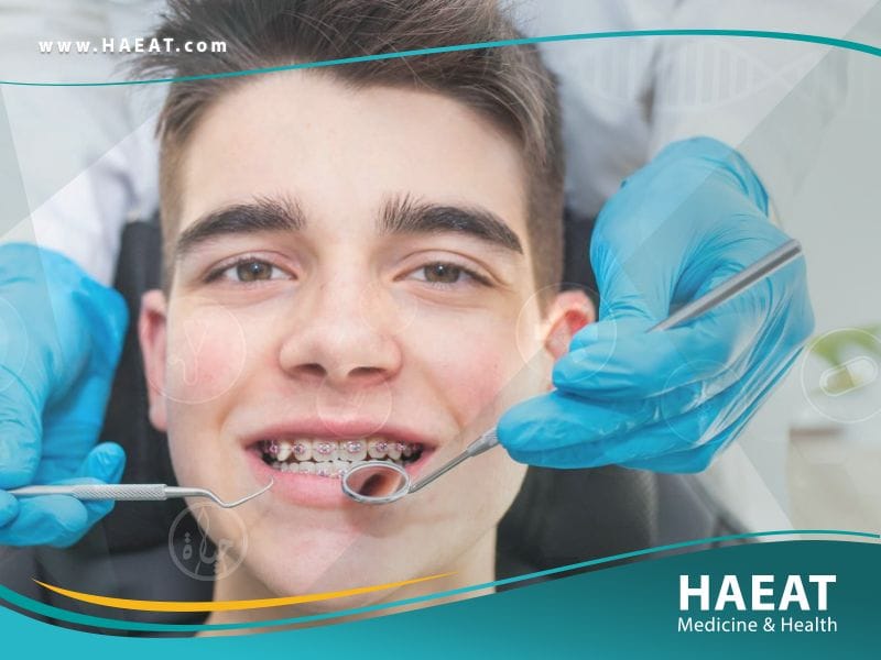 تقويم الاسنان