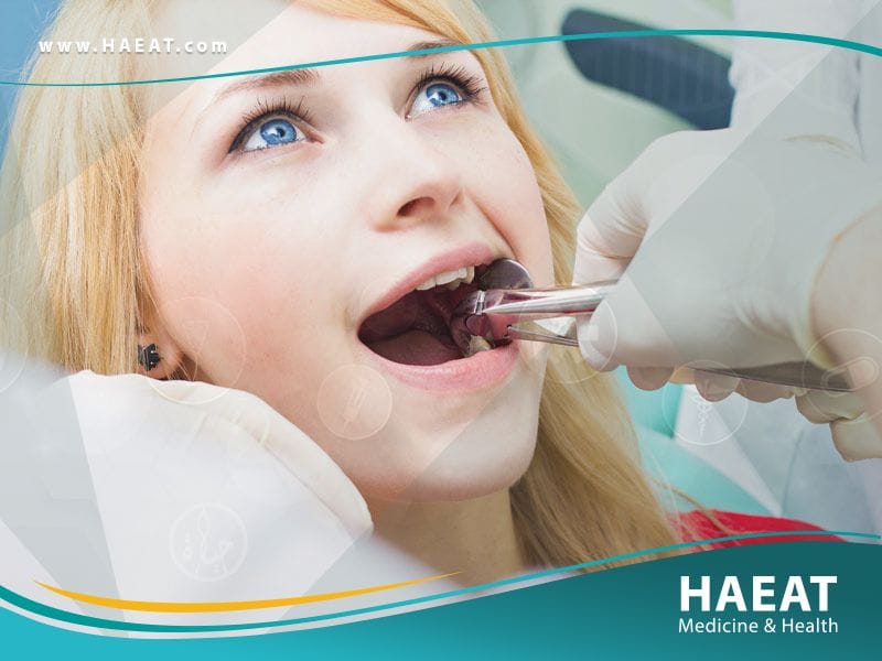 تقويم الاسنان